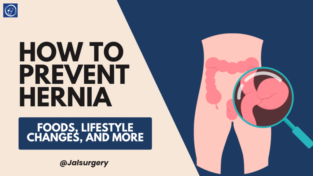 How to Prevent Hernia: Foods, Lifestyle Changes, and More