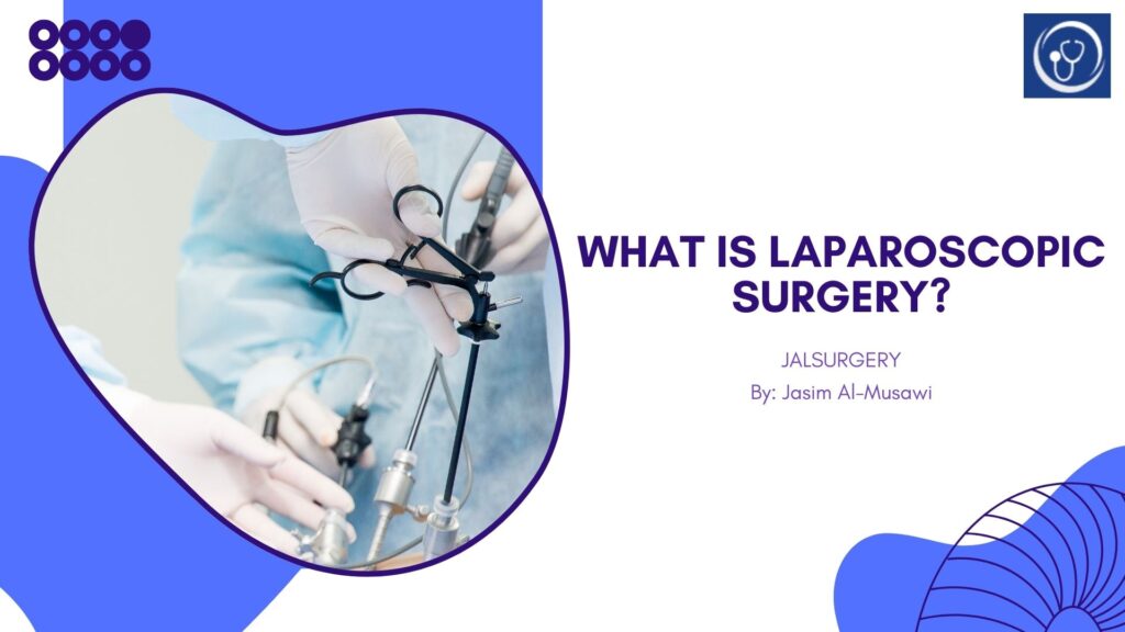 What Is Laparoscopic Surgery and Why Is It Preferred?